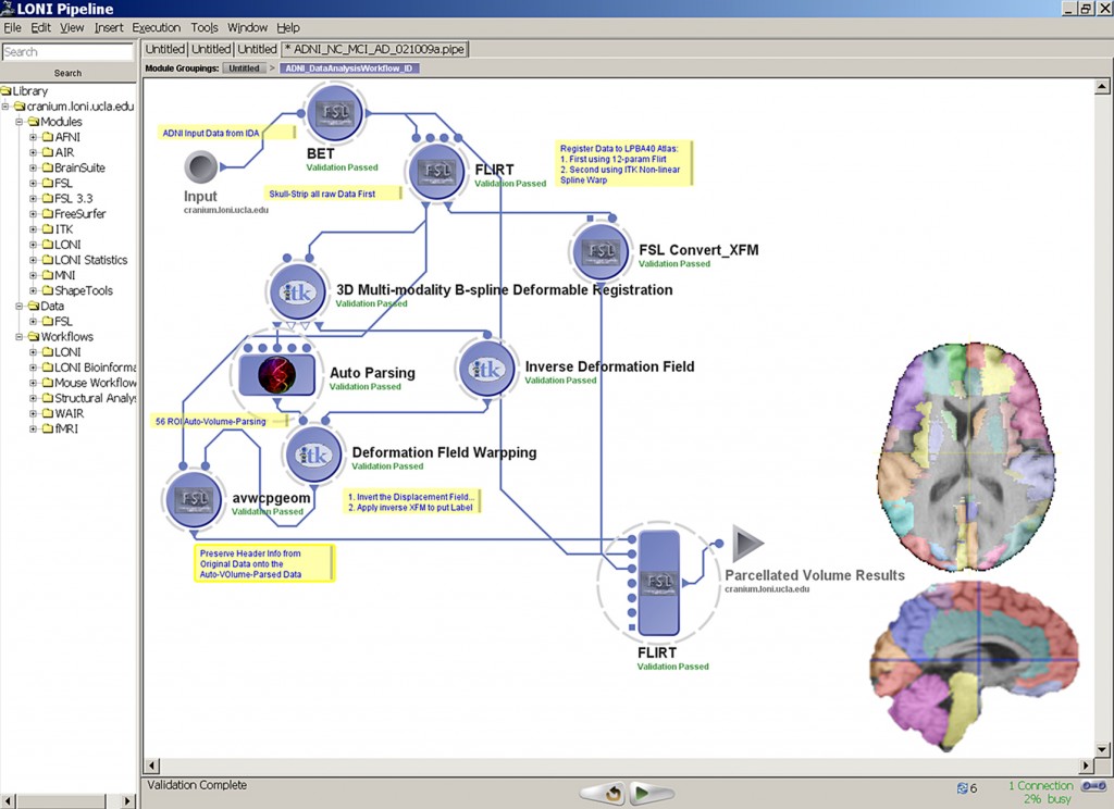 Example of the LONI Pipeline