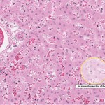 Pathology Workbench Zoomify Screen Shot